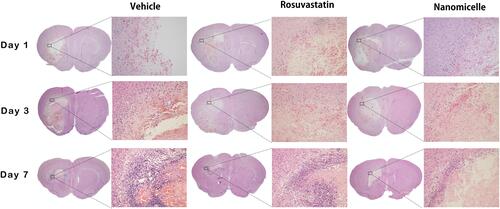 Figure 6 H&E staining. The overall morphology of the brain section at different time-point. Magnified images shows the surrounding of the lesion. Scale bar = 100 μm.