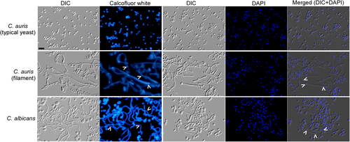 Fig. 2 Calcofluor White and DAPI staining of C. auris and C. albicans cells. C. auris cells were grown on YPD medium at 37 °C for 3 days and then transferred at 25 °C for three additional days of incubation. C. albicans cells were grown in liquid YPD plus 10% serum medium at 37 °C for 6 h and collected for staining assays. White arrows indicate septin rings and nuclei. Scale bar represents 10 μm