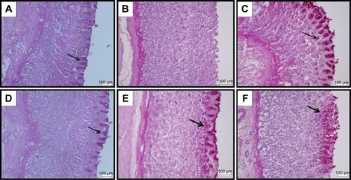 Figure 4 PAS staining.