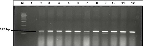 Figure 1 Representative Gel electrophoresis image of the confirmed DEC isolates recovered from diarrheagenic stool specimens. Lane (M) Molecular weight marker (100 bp DNA ladder, Thermo Scientific), lane 1: negative control, lane 2 to 12: Some of the positive diarrheagenic E. coli isolates.