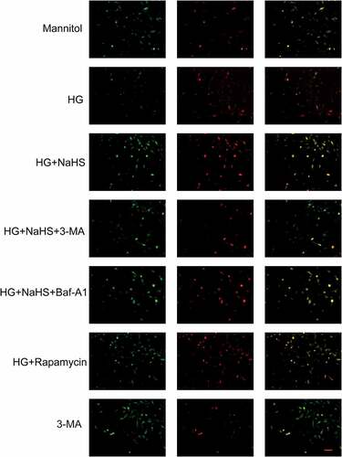 Figure 4. Effects of H2S on the autophagic flux. Autophagic flux was measured using an RFP-GFP-LC3 adenovirus. Representative fluorescence images of EPCs after incubation in different treatment groups (scale bar = 200 µm) are shown.