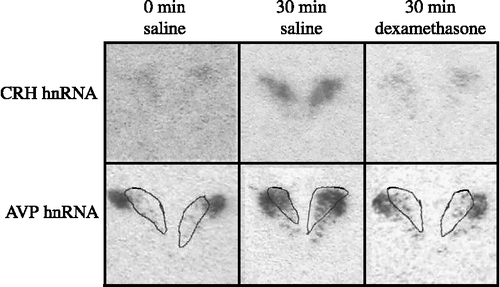 Figure 2 Shown are photomicrographs of representative images for CRH hnRNA (top panels) and AVP hnRNA (bottom panels) in the PVN from rats killed 0 min (left panels), 30 min (center panels) or 120 min (right panels) post-stress initiation on Day 2. Rats were given either 0.9% saline (left and center panels) or dexamethasone (right panels; 100 μg/kg, s.c.) 120 min before stress initiation. For AVP hnRNA, the medial parvocellular region of the PVN was defined by contours of CRH mRNA expression (white line) obtained from the adjacent section (not shown).