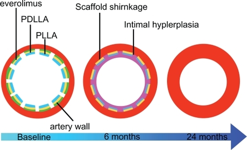 Figure 4 Bioabsorption process of the BVS stent and relative degradation times.