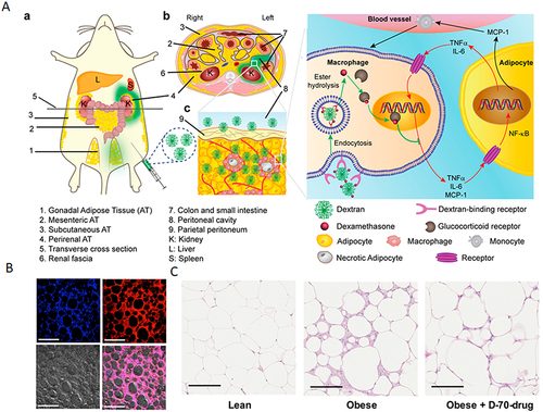 Figure 6 (A) Proposed mechanism of dextran-dexamethasone conjugate accumulation in obese Visceral Adipose Tissue (VAT), macrophage uptake, and uncoupling of the paracrine loop between M1 macrophages and adipocytes: (a) In obese mice following intraperitoneal left-side injection, dextran conjugates (highlighted in green) accumulate in the left perirenal adipose tissue (AT) and left gonadal AT. The anatomical depiction shows mice with different fat depots: one mesenteric, two perirenal, and two gonadal AT depots. (b) A transverse cross-section of the mouse abdomen illustrates the localization of the green dextran solution after administration into the peritoneal cavity. (cInflamed adipose tissue enables rapid association of dextran conjugates with M1 macrophages by transport across the peritoneum to directly access interstitial cells. (B) Dextran nanocarrier uptake by myeloid cells in the adipose tissue of obese mice. Obese mice were intraperitoneally injected with D-70-fluor. Twenty-four hours later, the left gonadal adipose tissue was isolated, sectioned, and stained with Hoechst dye. Confocal laser scanning microscopy images show the Hoechst channel (top left), the D-fluor channel (top right), bright-field microscopy (bottom left), and the overlay (bottom right). D-70 was observed within the interstitial space between adipocytes. Scale bars: 200 μm. (C) In vivo anti-inflammatory effects of D-70-drug in obese mouse VAT. Representative hematoxylin-and-eosin-stained images of paraffin-embedded gonadal adipose tissue isolated from each mouse group. Scale bar: 100 μm. Reprinted from Ma L, Liu TW, Wallig MA et al. Efficient targeting of adipose tissue macrophages in obesity with polysaccharide nanocarriers. ACS Nano. 2016;10(7): 6952–6962. Copyright 2016, with permission from ACS publications.Citation171