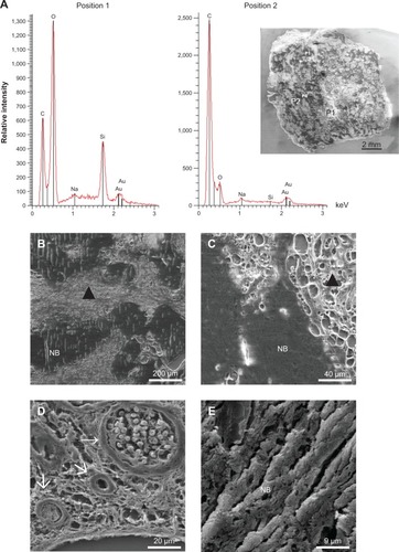 Figure 9 Scanning electron microscopy and energy dispersive x-ray spectroscopy.Notes: (A) Scanning electron microscopy and energy dispersive x-ray spectroscopy were performed for slides from each experimental group to determine the elemental composition in the constructs. In each section, two to eight different positions concerning structure and shading were chosen for measurement. In areas with no or slight tissue ingrowth, relatively high levels of silicon and oxygen could be detected, reflecting the original composition of the bone substitute particles (position 1). However, in areas with high tissue ingrowth, high carbon and low silicon levels were found, indicating the change from an inorganic to an organic matrix (position 2). (B–E) Different magnifications of the explants are shown. The nanohydroxyapatite bone substitute particles are surrounded by connective tissue and blood vessels, particularly on the borders of the explants. In centrally located areas with less or no tissue ingrowth, remodeling of the bone substitute could not be induced. Bone substitute, ▲: tissue ingrowth, arrows: newly formed blood vessels. NB = NanoBone®.