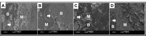 Figure 4 The SEM images (×2,000 magnification) of the porous n-HA/PA66 composite with implantation into the rabbit tibia.Notes: The interface of material and bone at (A) 2 weeks, (B) 8 weeks, (C) 12 weeks, and (D) 26 weeks. After 26 weeks, the porous n-HA/PA66 composites integrated with host bone completely.Abbreviations: SEM, scanning electron microscope; n-HA/PA66, nano-hydroxyapatite/polyamide 66; M, material; B, bone.