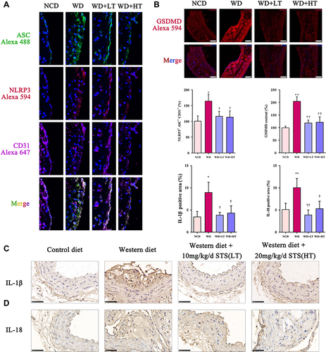 Figure 2 Sodium tanshinone IIA sulfonate alleviates the pyroptosis in atherosclerotic plaques. (A) NLRP3 and ASC in endothelial cells (marked by CD31) the aortic arches were detected by immunofluorescence. (B) GSDMD level in sections of the aortic arches was detected by immunofluorescence. (C) Immunohistochemistry analysis of IL-1β expression. (D) Immunohistochemistry analysis of IL-18 expression. Data are represented as mean ± SD of three independent replicates; *P < 0.05, **P < 0.01 vs NCD group; †P < 0.05, ††P < 0.01 vs AS model group; Scale bar = 50 μm.