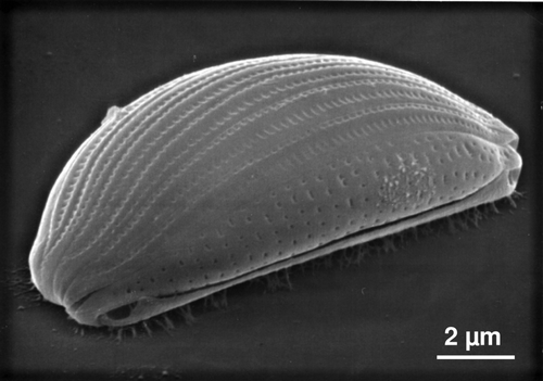 Figure 2. Micrograph of Amphora sp., showing the presence of EPS on a solid surface. This organism has two raphes (one is visible) both of which are on the ventral surface.