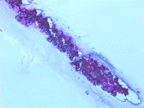 Figure 1 Photomicrographs of the cross-section of tumor spheroids showing a three-dimensional stratification. 200× Magnification.