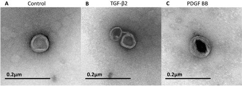 Fig. 3 Electron microscopy of purified exosomes. The exosomes are rounded and surrounded by a lipid bilayer. They have a somewhat electron dense content displaying a similar size of approximately 50–90 nm in diameter in all 3 treatment groups. A) Example of an exosome in the control group. B) Example of 2 exosomes in the TGF-β2-treated group. C) Example of an exosome in the PDGF-BB-treated group. All 3 exosome groups contained exosomes with different densities. Shown in the figure are the best pictures of exosomes from each group that happened to be of different density, but this does not indicate that there were any differences between the groups when taking all exosomes into account.