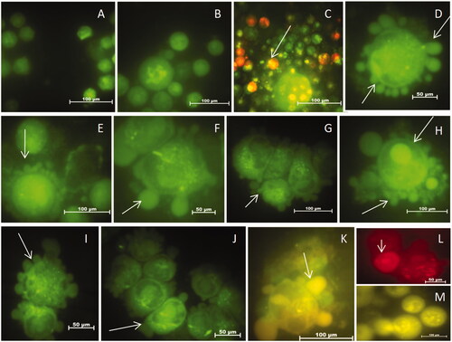 Figure 12. (A–m) Dose dependent detection of apoptosis in HeLa cells through Acridine Orange and Ethidium Bromide Staining after treatment with AgNPs. In the order: Control (A), vehicle control (B), positive control (c,d), 2 μg/mL (e,f) 4 μg/mL (g,h), 6 μg/mL (i–k), 8 μg/mL and (l,m) AgNPs respectively. Magnification: 100×. Arrows represent dead cells and apoptotic features such as nuclear condensation, fragmentation and apoptotic bodies.
