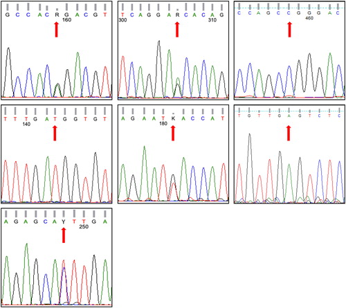 Figure 3. Electrophoregrams generated via Sanger sequencing to confirm SNaPshot fragment analysis of seven SNPs of a subject whose genotype based on capillary electrophoresis is GG/GG/CT/TT/GT/GA/TT referring to SNPs rs5443, rs1799884, rs13266634, rs5215, rs12255372, rs10965250 and rs4812829, respectively. These SNPs refer to genes GNB-3, GCK, SLC30A, KNJ11, TCF7L2, CDKN2A/B and HNF4A, respectively. Note that the pattern of CDKN2A/B gene is for the reverse order of the gene sequence.