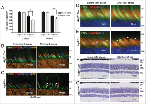 Figure 2. Light-induced damage to ATG5-deficient cone photoreceptors. (A) Twelve-wk-old Atg5f/+;Cre+ control (n = 4) and Atg5ΔCone mice (n = 5) were exposed to 13,000 lx for 7 h and returned to normal lighting for 1 wk. Cone counts performed on retinal flat mounts. Data represent the mean ± standard error. * denotes significantly different from control (p < 0.05); ns, not significant. (B) and (C) Representative confocal images of Atg5f/+;Cre+ (B) and Atg5ΔCone (C) retinae before and after light stress stained for PNA (green), OPN1MW/M-opsin (red), OPN1SW/S-opsin (blue), and DAPI (orange). (D) and (E) Representative confocal images of Atg5f/+;Cre+ (D) and Atg5ΔCone (E) retinae before and after light stress stained for PNA (green), TOMM20 (red), and DAPI (blue). (F) and (G). Representative images of Atg5f/+;Cre+ (F) and Atg5ΔCone (G) retinae before and after light stress stained with toluidine blue. RPE, retinal pigmented epithelium; OS, outer segment; IS, inner segment; ONL, outer nuclear layer; INL, inner nuclear layer. (n = 4−6 retina examined per group)
