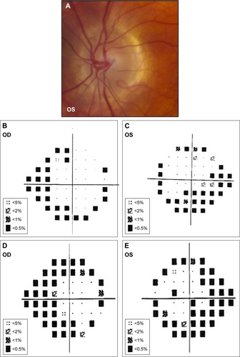 Figure 5 Patient 5.