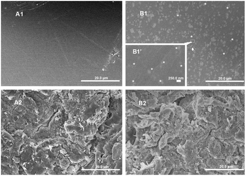 Figure 2 Scanning electron microscopy images of PEEK and n-TiO2/PEEK before and after blasted treatment. (A1) Smooth PEEK, (A2) rough PEEK, (B1) smooth n-TiO2/PEEK, and (B2) rough n-TiO2/PEEK.Notes: *n-TiO2 particles exposed to the surface of smooth n-TiO2/PEEK. (A1, A2, B1, and B2 bars, 20.0 μm; B1 bar, 250.0 nm).Abbreviation: PEEK, poly(ether-ether-ketone).