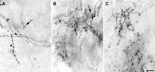 Figure 2 High power photomicrographs of boutons labeled after injections into V1 that filled a small number of layer 6 cells.