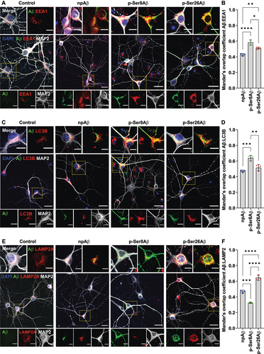 Figure 4. Phosphorylation-state specific intraneuronal sorting of Aβ to endo-lysosomal and autophagic compartments. (A, C, E) Primary cortical neurons were incubated without (control) or with the indicated Aβ variants (500 nM, 4 h) and co-stained with antibodies against the microtubule-associated protein 2 as neuronal markers (MAP2, gray), Aβ (82E1, green) and EEA1 (A, red), LC3 (C, red) or LAMP2 (E, red). Nuclei were stained with DAPI (blue). Scale bar: 10 µm. Dotted boxes indicate the regions zoomed in the merged panels (above) and individual channels (below). (B, D, F) Mander’s overlap coefficients between Aβ (green channel) with early endosomes, EEA1 (B); autophagic vesicles, LC3 (D) and lysosomes, LAMP2 (F) (respective red channels), analyzed by the Fiji ImageJ colocalization processing module. Values represent mean ± S.D.; n = 6, N = 3. * p = 0.05; ** p = 0.01; *** p = 0.001; **** p = 0.0001 (One-way ANOVA, GraphPad Prism). Additional data are shown in figure S4.