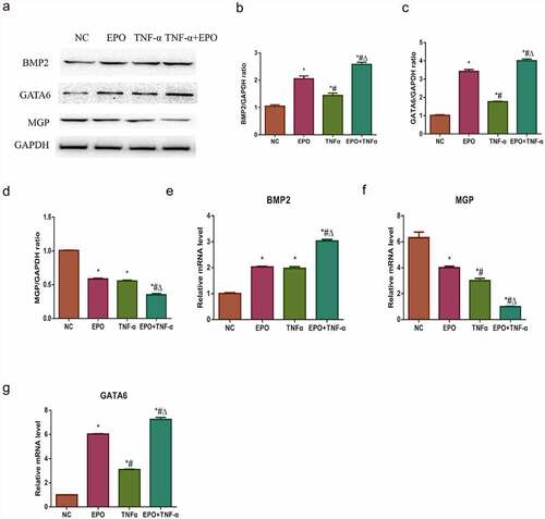 Figure 2. Effects of EPO and TNF-α on osteogenic gene and anti-calcification protein expression. VSMCs were cultured with single 250 U/mL EPO or combined with 20 ng/mL TNF-α for 8 d. A. Western blot results of BMP2, GATA6 and MGP protein expressions. B-D. Densitometric analysis of protein expression. E-G. The mRNA expressions of GATA6, BMP2 and MGP. The results are expressed as mean ± SD; n=3. * p<0.05 vs. NC group, # p<0.05 vs. EPO group, Δ p<0.05 vs. TNF-α group.