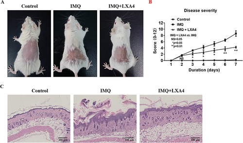 Figure 2  LXA4 alleviates the pathological features of psoriasiform dermatitis in mice. (A) After 7 days of continuous treatment, a representative picture of the dorsal skin of each group. (B) Each group of mice was assessed daily for epidermal erythema, scaling and thickening of the dorsal skin, the disease severity score was the sum of the scores of the three indicators. (C) Histology of lesions tissue (H&E stain, scale bar: 100 mm) of dorsal skin in three groups of mice. All data were conducted three independent experiments, and the representative results are shown. NS p>0.05, **p<0.01 and *p<0.05, compared with the mice in the IMQ group. Each bar represents the mean ± SD (n=8).