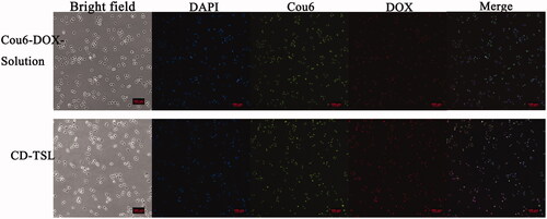 Figure 6. Cellular uptake of Cou6-DOX-solution and CD-TSL by H460 cells after 4 h incubation at 37 °C. Images of bright field, nuclei stained with DAPI (blue), 6-coumarin (green), DOX (red), and merged. Scale bar: 100 μm.