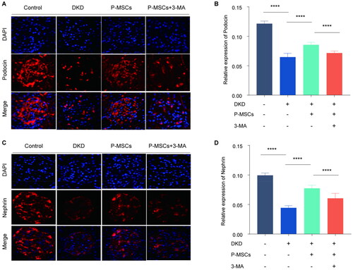 Figure 2. Effects of placenta-derived mesenchymal stem cells (P-MSCs) and 3-methyladenine (3-MA) on glomerular podocyte fissure membrane proteins podocin and nephrin in diabetic kidney disease (DKD) rats. A-B: Immunofluorescence was used to detect the expression of podocin in rat glomerulus. C-D: Effects of P-MSCs and 3-MA on nephrin in DKD rats. (****p < 0.0001).