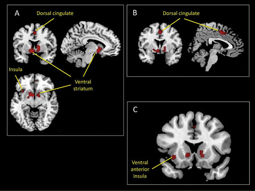 Figure 8. Main results of an ALE meta-analysis of neuroimaging studies of reward expectation (see the online supplementary material for additional information). This analysis revealed a number of activation foci that survived conservative statistical correction (p < .05 corrected for false discovery rate). Among these were activations within the insular cortex (A and C) and the dorsal mid-cingulate cortex (B).