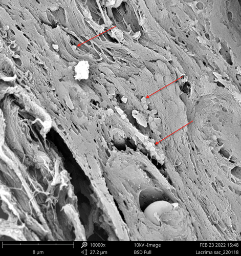 Figure 2. Bacteria were located not only on the luminal surface of the sacs, but also within the tissue of the sac (red arrows).