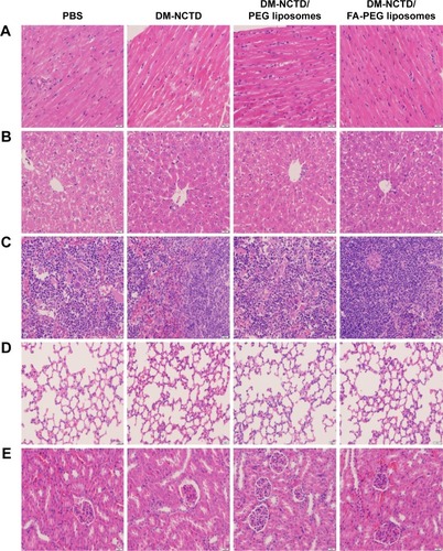 Figure 5 Tissues of H22 tumor-bearing mice stained with hematoxylin and eosin after in vivo antineoplastic activity study.Notes: (A) Heart; (B) liver; (C) spleen; (D) lung; (E) kidney. Bar 20 μm.Abbreviations: DM, diacid metabolite; NCTD, norcantharidin; FA, folic acid; PEG, polyethylene glycol; PBS, phosphate-buffered saline.
