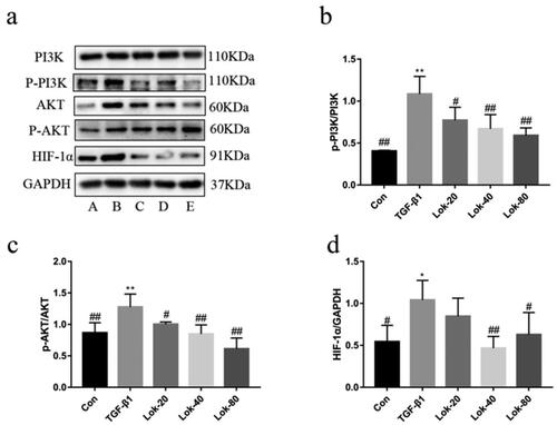 Figure 5. Protein levels of PI3K-AKT/HIF-1α were determined using Western blot. (a) The expression of p-PI3k, p-Akt and HIF-1α was detected by Western blot. A: control, B: TGF-β1 (10 ng/mL), C: TGF-β1 with Lok (10 ng/mL and 20 µg/mL respectively), D: TGF-β1 with Lok (10 ng/mL and 40 µg/mL, respectively), E: TGF-β1 with Lok (10 ng/mL and 80 µg/mL, respectively). Ratios of p-PI3K/PI3K (b), p-AKT/AKT (c) and HIF-1α (d) intensity. The obtained data are expressed as mean ± SD. n = 3,*p < 0.05, **p < 0.01, vs. con, #p < 0.05, ##p < 0.01, vs. TGF-β1.
