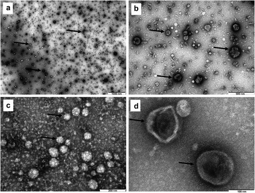 Figure 2. Transmission electron microscopy (TEM) of metabolic stress condition B16.F10 melanoma cells-derived nanosized EVs isolated through the UF-SEC technique. Exosomes were negatively stained with uranyl acetate. Dark arrows indicate the EVs, imaged as ‚cup-shaped’ structures with sizes averaging 60 nm. A – 1000 nm scale bar; B – 500 nm scale bar; C – 200 nm scale bar; D – 100 nm scale bar.