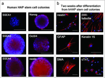 Figure 5. Nestin-expressing human HAP (hHAP) stem cell colonies differentiated to cardiac muscle and other types of cells.Citation31 (a) hHAP stem cell colonies are SSEA1-negative, SSEA3-, SSEA4-, Nanog-, Oct3/4-, and nestin-positive.Citation29 Scale bar = 100 µm. (b) Two weeks after transfer to DMEM containing 10% FBS, the nestin-expressing hHAP stem-cell colonies differentiated to nestin- and βIII-tubulin-positive neurons, GFAP-positive glial cells, K15-positive keratinocytes, smooth muscle actin-positive smooth muscle cells, and troponin (cTnT)-positive cardiac-muscle cells. Scale bar = 100 µm.