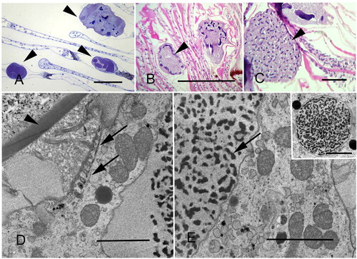 Figure 8. Thick and thin section microscopy of Synophrya. A. Synophrya hypertrophonts within the gill lamellae of Pandalus borealis (arrowheads). Plastic section. B. Synophrya hypertrophonts within the gill lamellae of P. borealis. Arrowhead indicates the peripheral chromatin of the macronuclear reticulum. Paraffin section. C. Synophrya cyst from P. borealis gills filled with multiple daughter cells, the hypertomite stage, which forms in premolt hosts (arrowhead). The dark structures within each cell are the macronuclei. Paraffin section. D-E. TEM of Synophrya from Achelous spinicarpus from the Gulf of Mexico. The hypertrophont cyst wall (arrowhead) is indicated. This very large stage has sparsely distributed ciliary rows. One is indicated by the arrows in D. The arrow in E indicates chromatin from the macronuclear reticulum. Inset: a rare section through the micronucleus. A. Toluidine blue. B-C. H & E. D-E uranyl acetate/lead citrate. Scale bars 200 µm (A, C), 500 µm (B), 3 µm (D, E), 5 µm (inset). Figures A, D and E used with permission from Lee et al. Citation2019 and Landers Citation2010. The remaining figures are new.