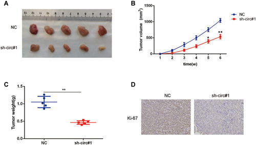 Figure 4 Circ-0003006 silencing suppresses the growth of HCC cell in vivo. (A) Representative images of xenografts tumor (five mice per group) in nude mice. (B and C) The volume(b) and weights(c) of xenograft tumors. (D) Immunostaining of Ki-67 expression in xenograft tumors. Data indicate the means ± SEM of three experiments, *p < 0.05, **p<0.01.