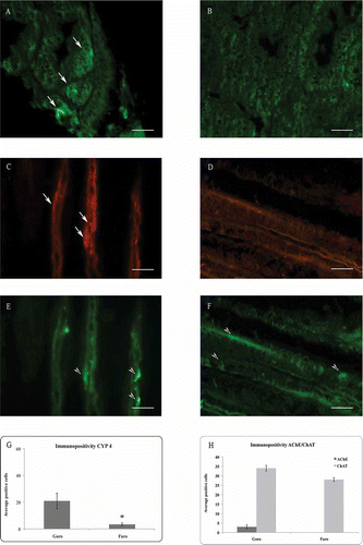 Figure 2. Immunolocalization of CYP4 (A, B) on mussel (Mytilus galloprovincialis) digestive gland, and AChE (C, D) and ChAT (E, F) on gills. (A) Control specimens showing a significant number of CYP4 immunopositive cells (arrow). (B) Specimens from Lake Faro, displaying few CYP4 positive cells. (C) Control specimens showing AChE immunopositive fibers (arrow) and (E) ChAT immunopositivite fibers (arrowhead) along the gill epithelium. (D) Specimens from Lake Faro, displaying a drastic reduction of AChE immunopositivity, and (F) ChAT immunopositivite cells (arrowhead) along the gill epithelium. Mean and standard deviation (SD) of immunopositive cells (G, H). Asterisk indicates a significant difference at P < 0.0001. Scale bars: 10 μm. CYP4 = cytochrome P450 4; AChE = acetylcholinesterase; ChAT = choline acetyltransferase.