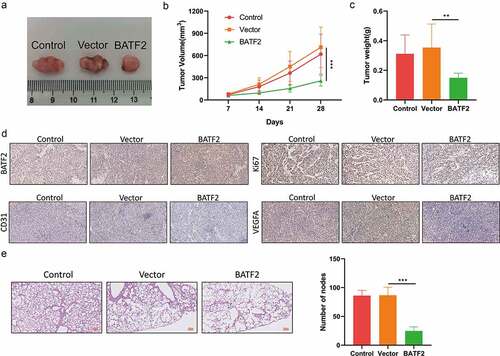 Figure 8. Effect of BATF2 on TSCC cell growth and metastasis in vivo.