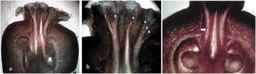 Figure 4. V.S. of female flower (a), stigmatic canals (b) - 1, 2, 3, 4, 5, 6.) (c) stylar canal (arrow) leading towards ovule.