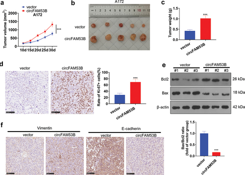 Figure 4. CircFAM53B boosted A172 cell proliferation and EMT in vivo.