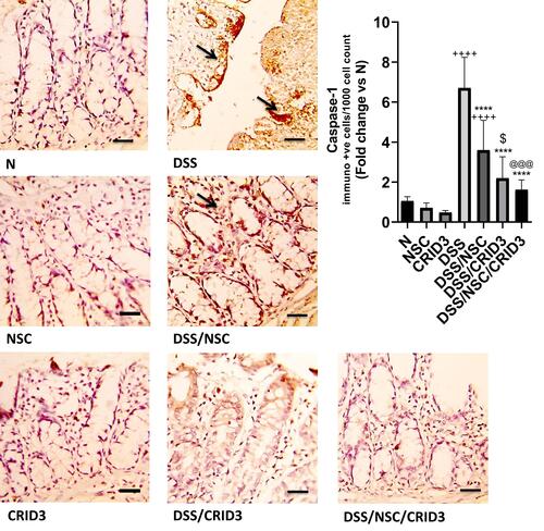 Figure 3 Immunostaining of caspase-1. Photomicrographs of colon specimens from: (N), (NSC), and (CRID3) show scarce caspase-1 cytosolic expression within the glandular epithelia and the interstitial tissue; (DSS), shows marked expression of caspase-1 within the desquamated covering epithelium and within the interstitial tissues (open arrows); (DSS/NSC), shows moderate decrease in the caspase-1 expression either within epithelial lining of the intestinal glands and within the interstitial tissues (open arrow); (DSS/CRID3), shows moderate reduction in the caspase-1 expression either in epithelia of the glands and in the interstitial tissues (open arrow); (DSS/NSC/CRID3), shows a more pronounced decrease in the caspase-1 expression. As shown in caspase-1 immunoreactivity evaluation figure, a significant reduction in the percentage of caspase-1 immunopositive cells/1000 counted cells was detected in rats with ulcerative colitis that were treated with NSC, CRID3, and NSC/CRID3 compared with the untreated DSS-insulted rats. Caspase-1 IHC, bar = 50 µm. ++++P < 0.0001 vs N, ****P < 0.0001 vs DSS, @@@P < 0.001 vs DSS/NSC, $P < 0.05 DSS/CRID3 vs DSS/NSC.