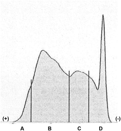 Figure 2. Lipoprotein electrophoresis of the milky fluid. (A) high density lipoprotein, (B) very low-density lipoprotein, (C) low density lipoprotein, (D) chylomicron.