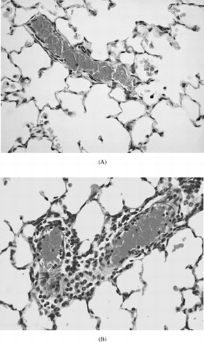 Figure 1 Representative HE stained lung sections of female BN rats exposed to the control diet (A, ×200) or 450 mg HCB/kg diet (B, C) for 21 days. HCB exposure caused marked perivascular infiltrates of predominantly eosinophinilic granulocytes (B, ×200). Granulomas consisting of monocytes and macrophages and Langerhans-type giant cells were also observed (C, ×40).