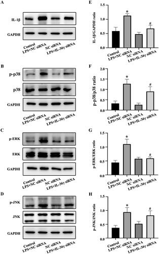 Figure 6. IL-36γ siRNA reduces the secretion of IL-1β in Beas-2B cells and inhibits the activation of mitogen-activated protein kinase (MAPK) pathways under lipopolysaccharide (LPS) stimulation. (A–D) IL-1β, p-p38, p38, p-REK, ERK, p-JNK, JNK in Beas-2B cells under LPS stimulation as detected by western blotting. (E–H) Protein intensity analysis of IL-1β, p-p38, p38, p-REK, ERK, p-JNK, JNK in Beas-2B cells under LPS stimulation as detected by western blotting. *p< 0.05 versus the control group. #p< 0.05 versus the LPS + NC siRNA group.