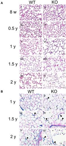 Figure 2 Morphology and elastic fiber formation in the lungs during aging process. (A) Representative hematoxylin and eosin (HE)-stained images of lung tissues from wild-type (WT) and Secretoglobin (Scgb) 3a2-knockout (KO) mice at 8 weeks old (8 w) and from 0.5 to 2 years old (0.5–2 y) (i–x). In WT mouse lungs, the expansion of the alveolar cavity was occasionally observed in the lungs of 1.5 y and 2 y. Conversely, in Scgb3a2-KO mouse lungs, more numbers of alveoli with remarkable cavity expansion were observed after 1 year of age (1 y) (vi, viii, and x). Scale bars: 50 µm. (B) Representative Victoria blue (VB) staining of lung tissues from WT and Scgb3a2-KO mice from 1 year (1 y) to 2 years (2 y) of age (i–vi). In both WT and KO lungs, some of cleaved alveolar walls were stained dark blue stain by VB staining (arrowheads). A high degree of elastin fiber destruction was observed in the alveoli of KO mouse lungs (ii, iv, and vi). Asterisk (*): elastin fiber destruction, Blue: VB elastin staining, Scale bars: 20 µm.