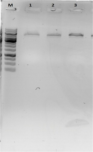 Figure 20 Extraction of the transformed plasmid (pET-28a Recombinant Vector (containing V1-domain of the CD166 and two epitopes of CD326) M, Gene Ruler™ 1 kb ladder; Lane 1, 2, and 3: Extraction of the transformed plasmid.
