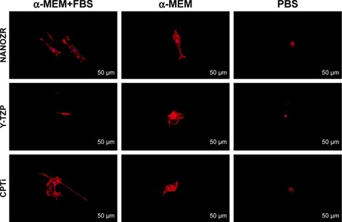 Figure 5 Observation of actin cytoskeleton and nucleus of MC3T3-E1 cells cultured in three different culture media: PBS, α-MEM, and α-MEM supplemented with 10% FBS, on all surfaces after 24 hours of incubation.