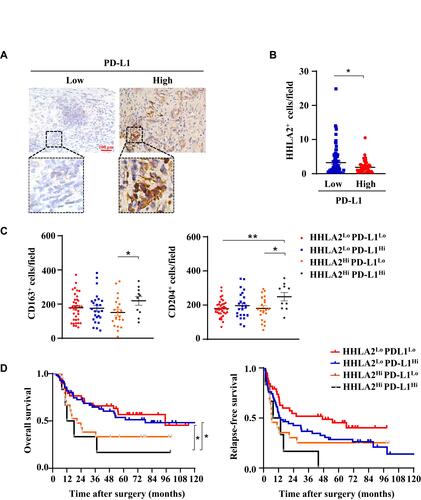 Figure 5 Different expression patterns of HHLA2 and PD-L1 in HCC. (A) Representative images of PD-L1 expression in the peri-tumor region of HCC tissue (scale bar: 100 μm). (B) The correlation between HHLA2 and PD-L1 expression in the peri-tumor region of HCC. (C) The relationship between HHLA2/PD-L1 expression patterns, as well as the infiltration of CD163+ and CD204+ cells. (D) Kaplan-Meier curves of HHLA2/PD-L1 expression patterns in HCC patients. *P < 0.05 and **P < 0.01.