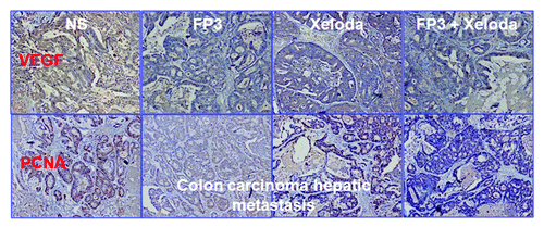 Figure 8. Effects of FP3 and capecitabine (Xeloda) on the expression of VEGF and PCNA in the PDTT xenograft models of colon carcinoma hepatic metastasis. Original magnifications, × 100.