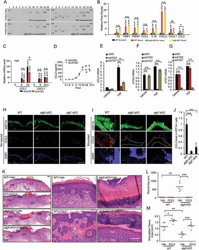 Figure 4. Epidermal autophagy deficiency inhibits wound healing through inhibiting CCL2. (A) Mouse cytokine array of normal and wounded skin (wound and adjacent area) sections on day 3 in WT and atg5 cKO mice. Dots with alterations were indicated by blue and red line. (B) The relative mean pixel density (fold of WT Non-Wound) of cytokines was listed with a mouse cytokine array assay (n = 6). (C) Real-time PCR for CCL2 and CXCL1 mRNA level in HaCaT cells stably transfected with shCON or shATG5 at 0, 6 and 24 h following TNF treatment. (D) CCL2 production in conditioned medium from HaCaT cells infected with shCON and shATG5 over a time course following TNF treatment. (E, F, and G) Real-time PCR analysis for CCL2 in NHEK cells transfected with siNC, siATG5, and siATG7, treated with or without TNF (100 ng/ml) for 8 h. Data are shown as mean ± S.E. (n ≥ 3). (H and I) Immunofluorescence staining of KRT14 and CCL2 in intact (H) and wound skin (I) on day 2 in WT, atg5 cKO, and atg7 cKO mice. Scale bar: 50 μm. (J) Quantification of the levels of CCL2 in wound healing on day 2 (I) was analyzed by ImageJ (N = 15). The right side of blue dot line is the wound area, and the inside of white dot indicates the area of keratinocyte expressing KRT14. (K) Wound healing as monitored by histological staining at day 8 after injury in WT, atg5 cKO mice with or without CCL2 topical treatment. Epi: epidermis; Der: dermis; Es: eschar. Scale bars: 200 (left panel) and 100 (right penal) µm. (L and M) Quantification of wound gap (L) granulation tissue (M) in K (n = 6). *, P < 0.05; **, P < 0.01; ***, P < 0.001; between comparison groups. #, P < 0.05; ##, P < 0.01 for B and C; compared with their corresponding non-wounded control groups. n.s., not statistically significant. Student’s t-test. Results were obtained from at least three independent experiments (C-G)