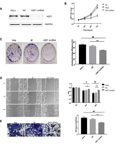 Figure 4 Knocking down HSF1 in HeLa cells reduces its malignancy in vitro. (A) Western blot displayed decreased HSF1 expression in HeLa-shHSF1 cells. (B) The cell activity of HeLa, NC and HSF1-shRNA groups was detected by MTT assay. (C) The cell proliferation of HeLa, NC and HSF1-shRNA groups was detected by clone formation assay. (D) Scratch analysis showed the width of the scratch at 24h, 48h was wider in HeLa-shHSF1 cells than in HeLa and NC cells. (E) Transwell analysis showed the OD 570 absorbance of HeLa-shHSF1 cell is lower than HeLa-NC and blank HeLa cells. The differences between the HeLa-shHSF1 cells, HeLa and HeLa-NC cells were significant (#P< 0.05, *P < 0.05, ##P< 0.01, **P < 0.01).