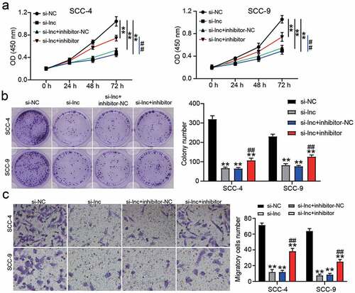 Figure 4. miR-545-3p inhibitor affect the function of si-CASC9 in OSCC cells. (a) The cell proliferation in SCC-4 and SCC-9 cells with the transfection of si-CASC9 and/or miR-545-3p was detected by CCK8 assay. (b) The colony formation in SCC-4 and SCC-9 cells with the transfection of si-CASC9 and/or miR-545-3p inhibitor was measured by colony formation assay. (c) The cell migration in SCC-4 and SCC-9 cells with the transfection of si-CASC9 and/or miR-545-3p inhibitor was assessed by transwell assay. **P < 0.01 compared with si-NC. ##P < 0.01 compared with si-lnc+inhibitor-NC. The data were analyzed by two-way ANOVA. si-NC, siRNA negative control. si-lnc, si-CASC9. inhibitor-NC, inhibitor negative control. inhibitor, miR-545-3p inhibitor