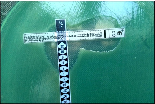 Figure 2 Colistin/meropenem combination test (Pseudomonas aeruginosa).